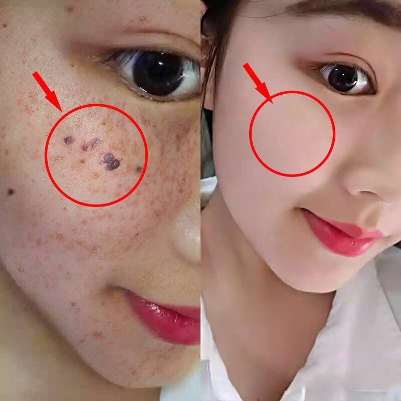 Organic Skin Tag Care Serum