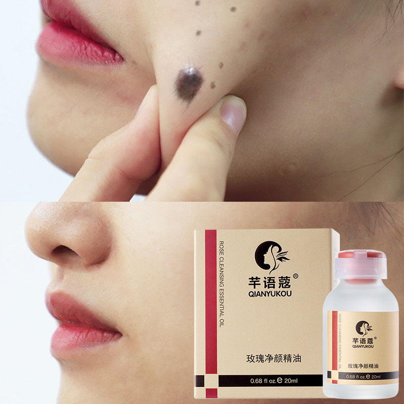 Organic Skin Tag Care Serum